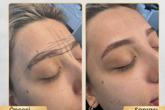Profesyonel Kaş Tasarımı